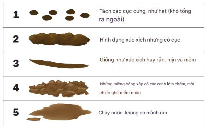 Thang phân Bristol dành cho trẻ em